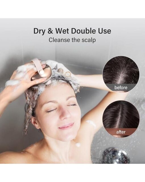 Scalp Massager 5in1 Waterproof with 8 Removable Claws - Image 6